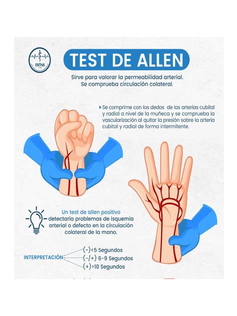Diagrama de la Maniobra de Allen, mostrando la compresión y liberación de las arterias radial y cubital.