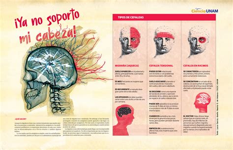 Infografía sobre tipos de dolor de cabeza y abuso de analgésicos