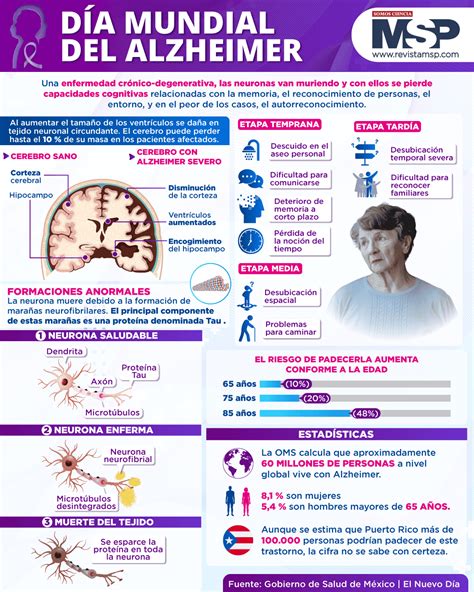 Infografía: Servicios especializados para Alzheimer y demencias en residencias