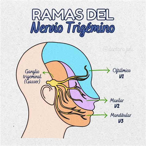 Diagrama que ilustra la compresión del nervio trigémino por un vaso sanguíneo