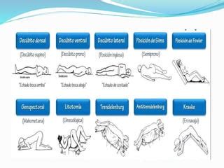 Esquema de posicionamiento adecuado del paciente hemipléjico en diferentes decúbitos