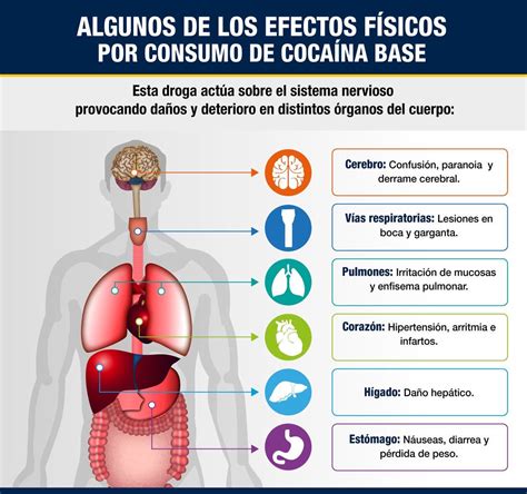 Infografía sobre los efectos del consumo de sustancias en el desarrollo cerebral adolescente (corteza prefrontal y circuitos de recompensa)