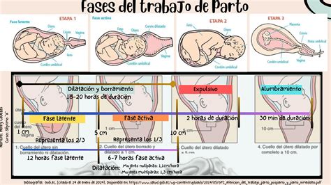 Secuencia de imágenes que representan las fases del parto