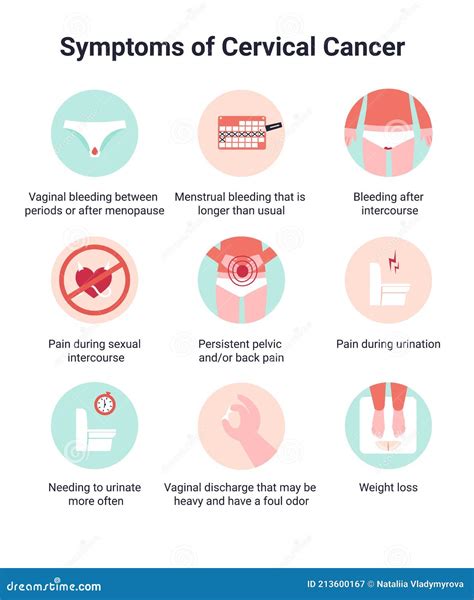 Ilustración de los síntomas comunes del cáncer de cuello uterino avanzado