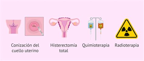 Representación visual de las opciones de tratamiento para el cáncer de cuello uterino: cirugía, radioterapia y quimioterapia