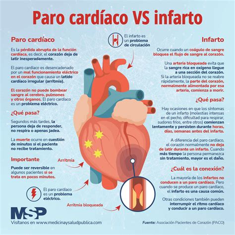 Esquema comparativo de infarto de miocardio, paro cardíaco e insuficiencia cardíaca