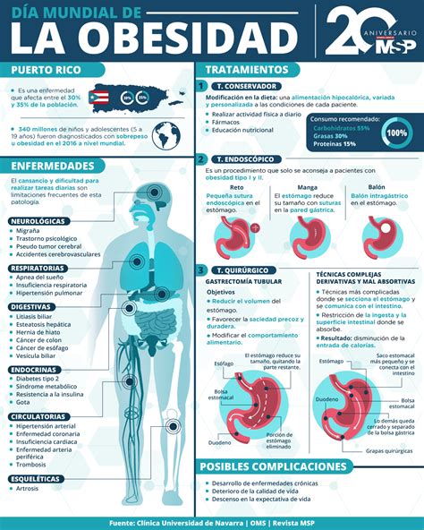 infografía sobre la prevalencia de obesidad en la población general y militar