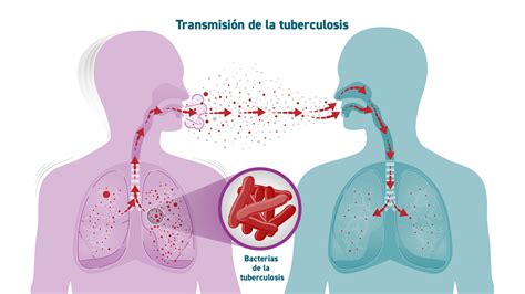 Esquema de transmisión de Mycobacterium tuberculosis por vía aérea