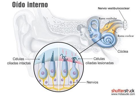 Gráfico que muestra la estructura del oído humano y las células ciliadas del oído interno.