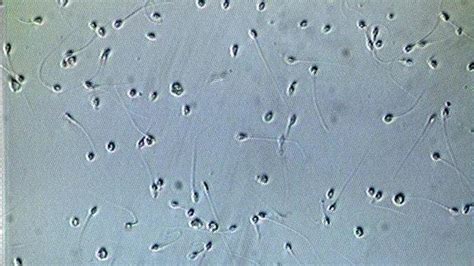 foto de archivo de una clínica de fertilidad o un microscopio con espermatozoides