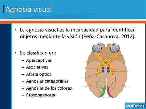 Esquema cerebral mostrando las áreas afectadas por la agnosia visual y prosopagnosia