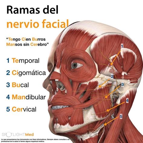 Ilustración anatómica del nervio facial y sus ramas