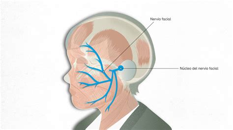 Diagrama que muestra un vaso sanguíneo comprimiendo el nervio facial