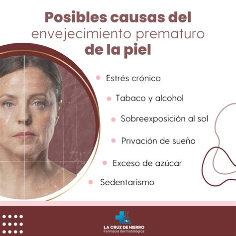 Infografía: Factores de envejecimiento prematuro de las manos (sol, agua, productos químicos)