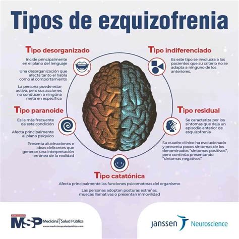 Infografía sobre los factores etiológicos de la esquizofrenia (genéticos, ambientales, neurodesarrollo)