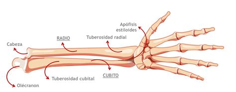 Esquema de la anatomía de la muñeca y el antebrazo con la ubicación de la fractura de Colles