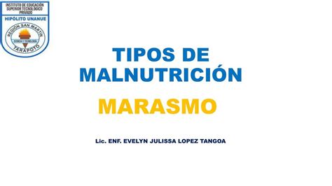 Ilustración esquemática de los diferentes tipos de malnutrición.