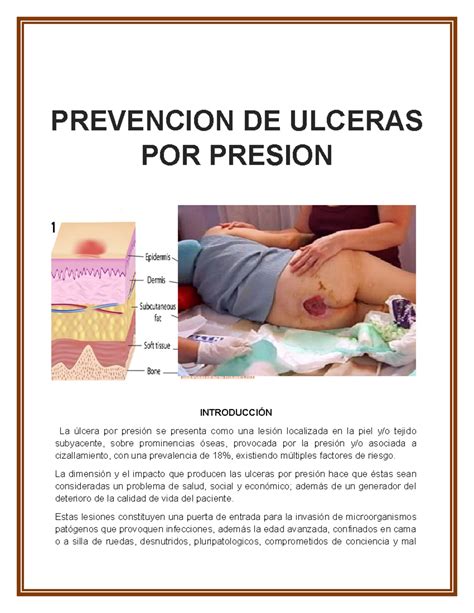 Infografía: Qué son las úlceras por presión y cómo afectan a la piel