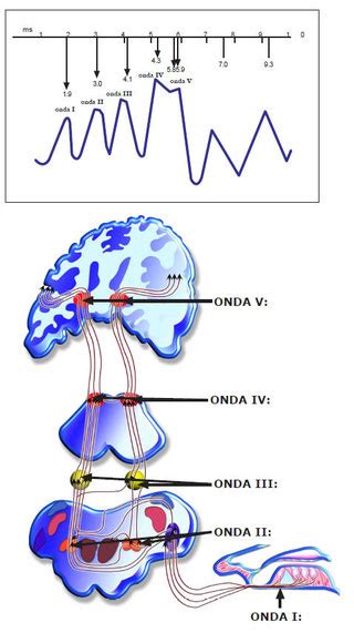 Gráfico mostrando las ondas de un PEATC