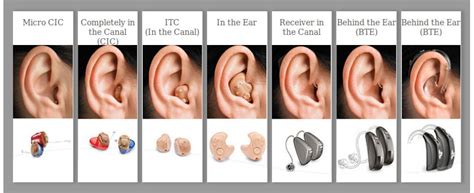 Esquema de los diferentes tipos de audífonos intracanales (ITE, ITC, IIC, CIC)