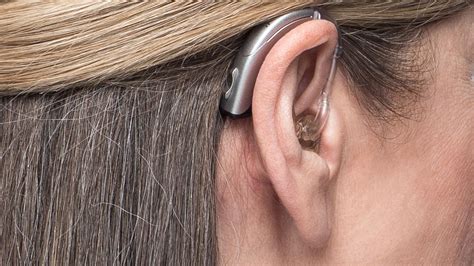 Fotografía de un audífono retroauricular (BTE) en la oreja
