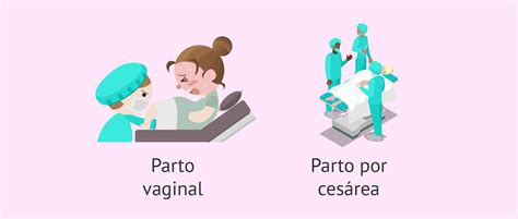 Esquema comparativo de servicios incluidos en parto vaginal vs. cesárea bajo modalidad PAD