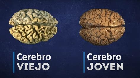 Gráfico comparativo del cerebro joven y envejecido, destacando atrofia y adelgazamiento de la corteza