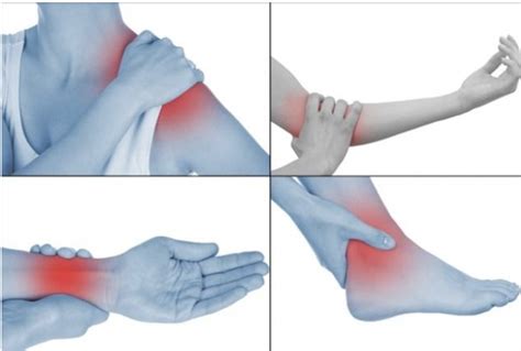 Esquema de las causas de la tendinitis (movimientos repetitivos, malas posturas, sobrecarga)