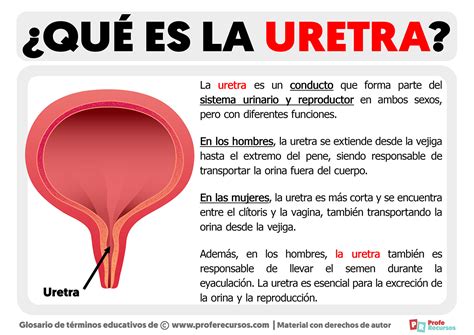 Esquema que ilustra la obstrucción de la uretra por una próstata agrandada.