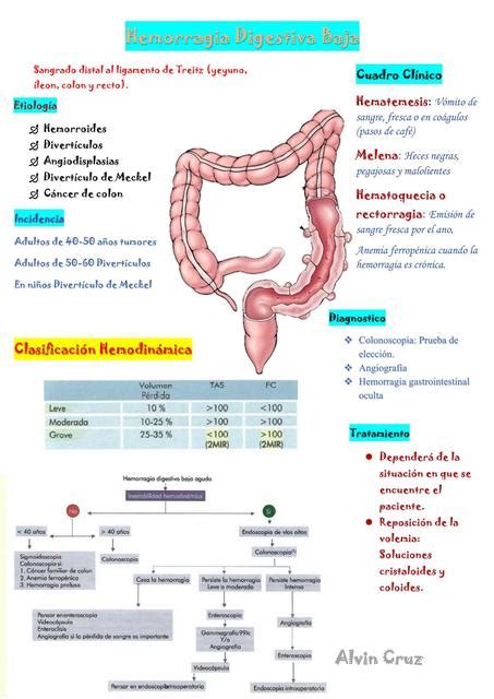 Infografía mostrando las posibles localizaciones de la hemorragia digestiva baja en el colon y recto.