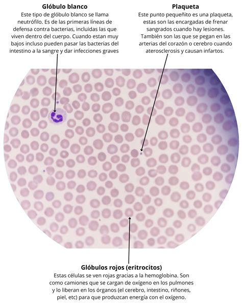Micrografía de un frotis de sangre periférica normal con eritrocitos y leucocitos