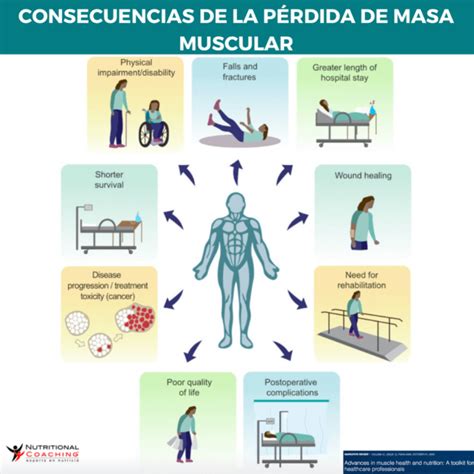 Esquema de la progresión de pérdida de masa muscular con la edad y la importancia del entrenamiento de fuerza