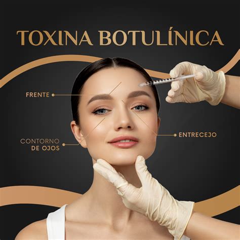 Imagen de una jeringa con toxina botulínica, simbolizando el tratamiento.