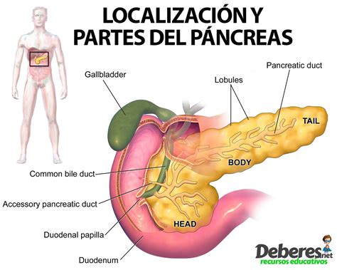 Esquema del páncreas con indicación de tumores y anatomía