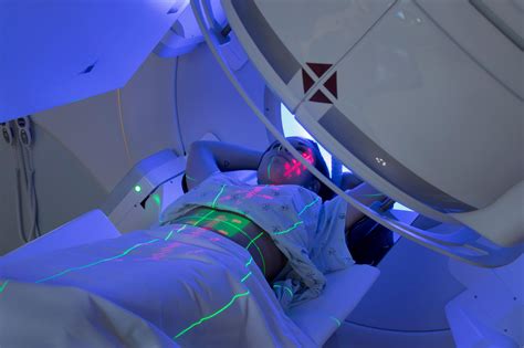Ilustración de radioterapia focalizada en el área del páncreas