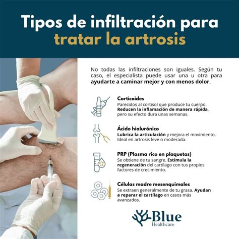 Infografía que muestra las diferentes técnicas de infiltración para el tratamiento del dolor lumbar y ciático.