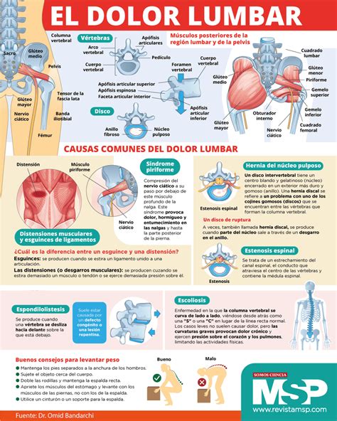Infografía con consejos prácticos para la prevención del dolor lumbar y la lumbociática.