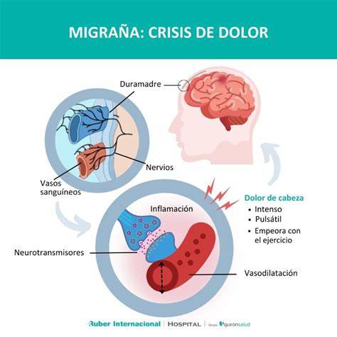Logo y fachada del Centro de migraña y dolor de cabeza de Kiel