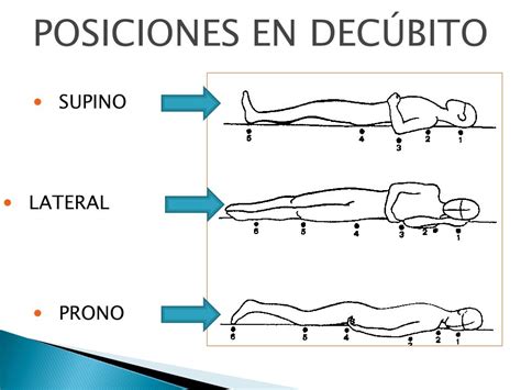 Diagrama mostrando las diferentes posiciones de decúbito: supino, lateral y prono, con puntos de apoyo y alineación.