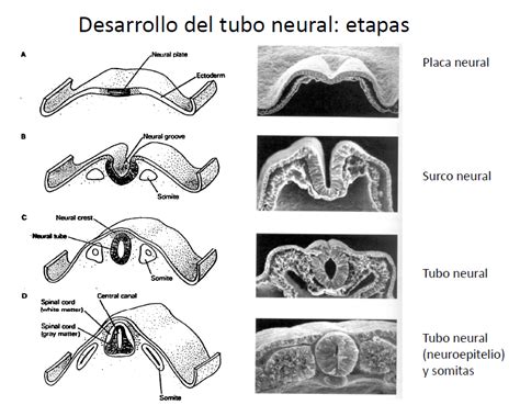Esquema del desarrollo del tubo neural y formación del mielomeningocele