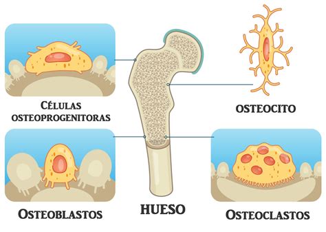 Esquema de la interacción entre células tumorales, osteoblastos y osteoclastos en metástasis óseas.
