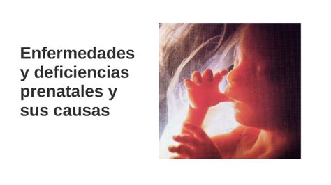 Esquema detallado de las causas prenatales, perinatales y postnatales de la discapacidad intelectual