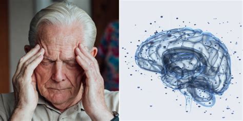 Gráfico mostrando factores de riesgo de deterioro mental en la vejez