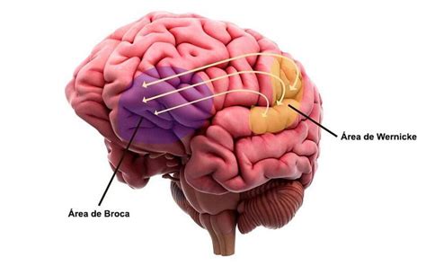Esquema del cerebro humano mostrando las áreas de Broca y Wernicke relacionadas con el lenguaje
