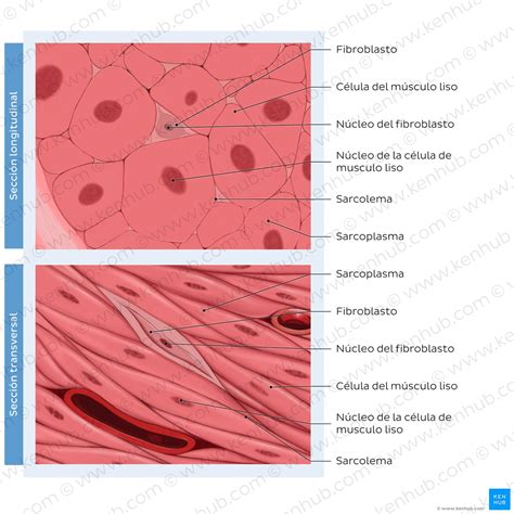 diagrama comparativo entre músculo sano y músculo sarcopénico