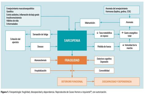 Esquema de las interrelaciones entre envejecimiento, fragilidad y dependencia