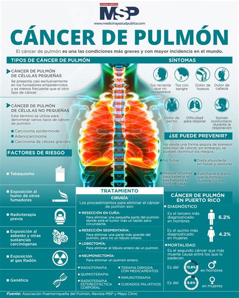 Infografía sobre los factores de riesgo del cáncer de esófago