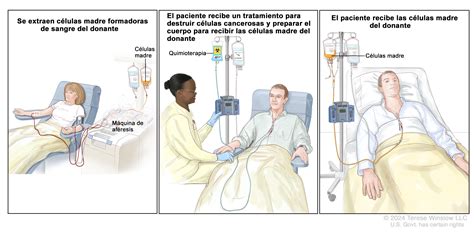Esquema de las principales opciones de tratamiento para la leucemia
