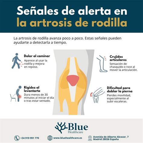 infografía sobre las etapas de la artrosis y sus síntomas