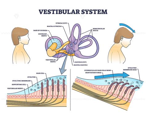 infografía sobre el sistema vestibular: componentes periféricos (oído interno) y centrales (cerebro) y su relación con el equilibrio